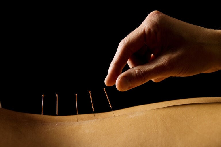 Can My FSA Cover Acupuncture or Other Alternative Pain Treatments?