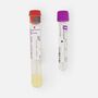 Kihealth Diabetes Risk Test - Earliest Detection Test for Diabetes, , large image number 2