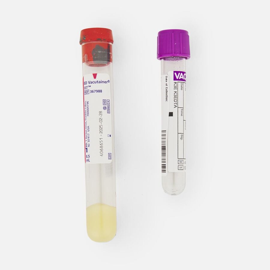 Kihealth Diabetes Risk Test - Earliest Detection Test for Diabetes, , large image number 2