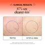 Derma E Acne Blemish Control Treatment Serum, 2 fl. oz., , large image number 4