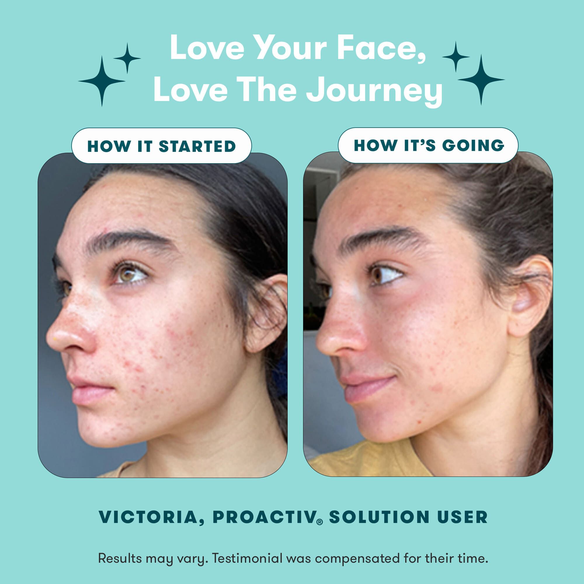 Proactiv Solution® 3-Step Routine 30-Day Kit by Proactiv | FSA Store