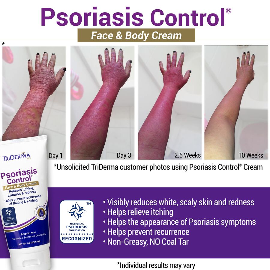 TriDerma Psoriasis Control® Face & Body Cream, 6 oz. Tube, , large image number 2