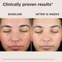 EltaMD UV Skin Recovery Broad Spectrum SPF 50 Face Sunscreen, , large image number 3
