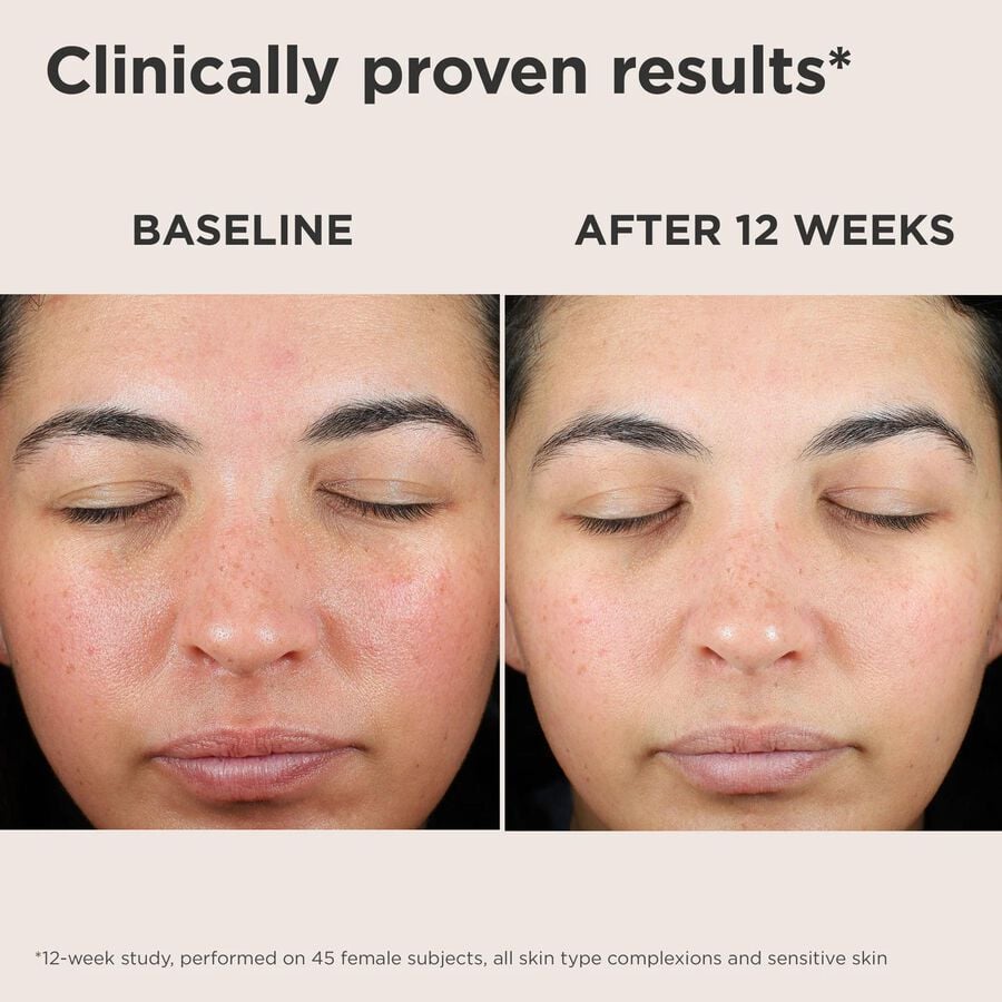 EltaMD UV Skin Recovery Broad Spectrum SPF 50 Face Sunscreen, , large image number 3