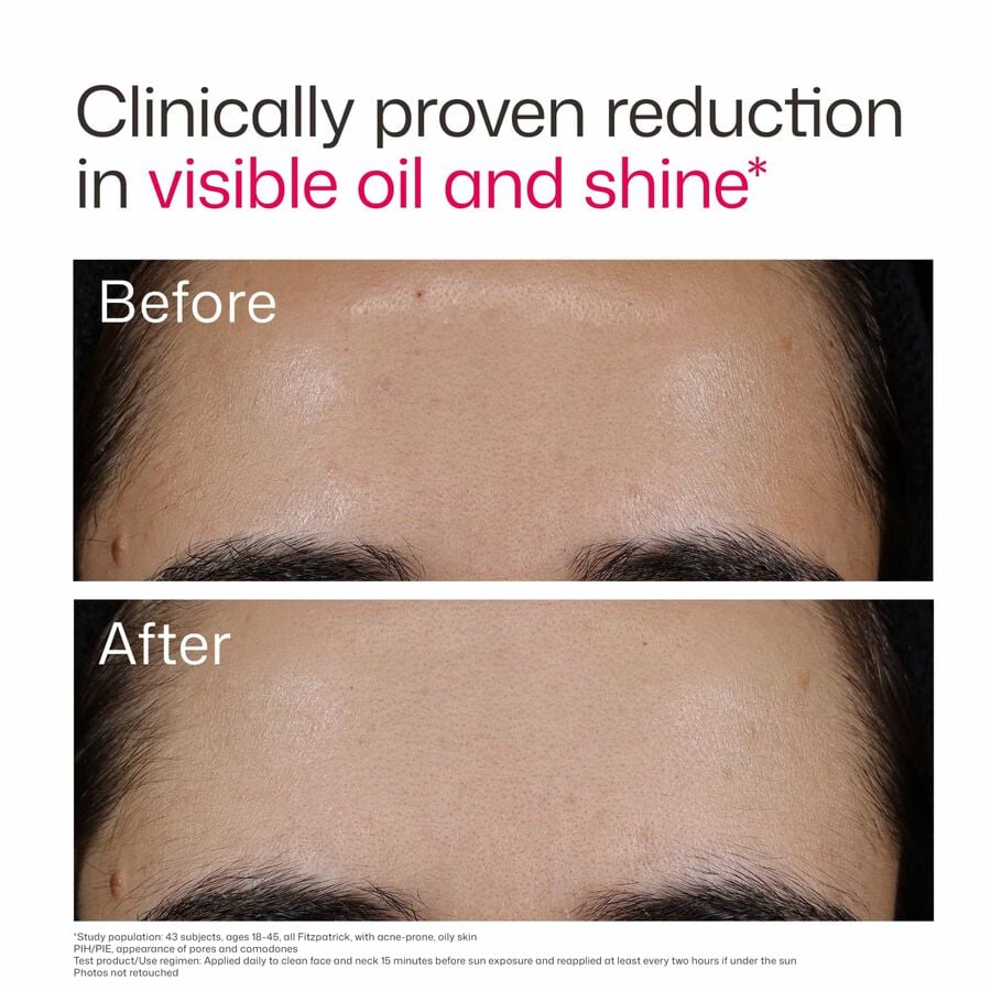 EltaMD UV Clear Blemish-Prone & Oil Balancing, SPF 50, 1.7 oz., , large image number 7