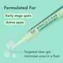Rael Miracle Clear Soothing Spot Gel, 0.14 fl oz., , large image number 1
