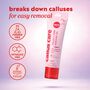 ONYX Professional Callus Care Callus & Corn Peeling Gel, , large image number 3