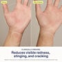 Skinfix Hand Relief Cream, 3 fl. oz., , large image number 4