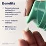 Skinfix Adapinoid&reg; Gel, 1 fl. oz., , large image number 1