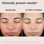 EltaMD UV Skin Recovery Red Color Correcting Green Tint Broad Spectrum SPF 50, , large image number 3