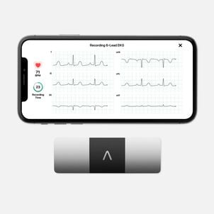 AliveCor KardiaMobile Personal EKG 6L